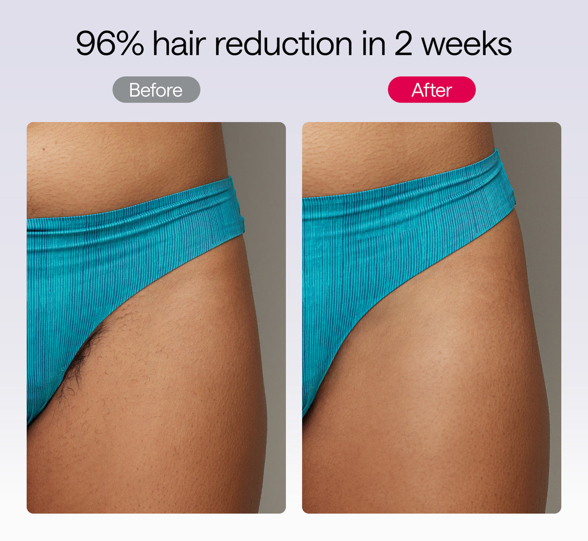Ulike Laser Hair Removal, Air 10 IPL New