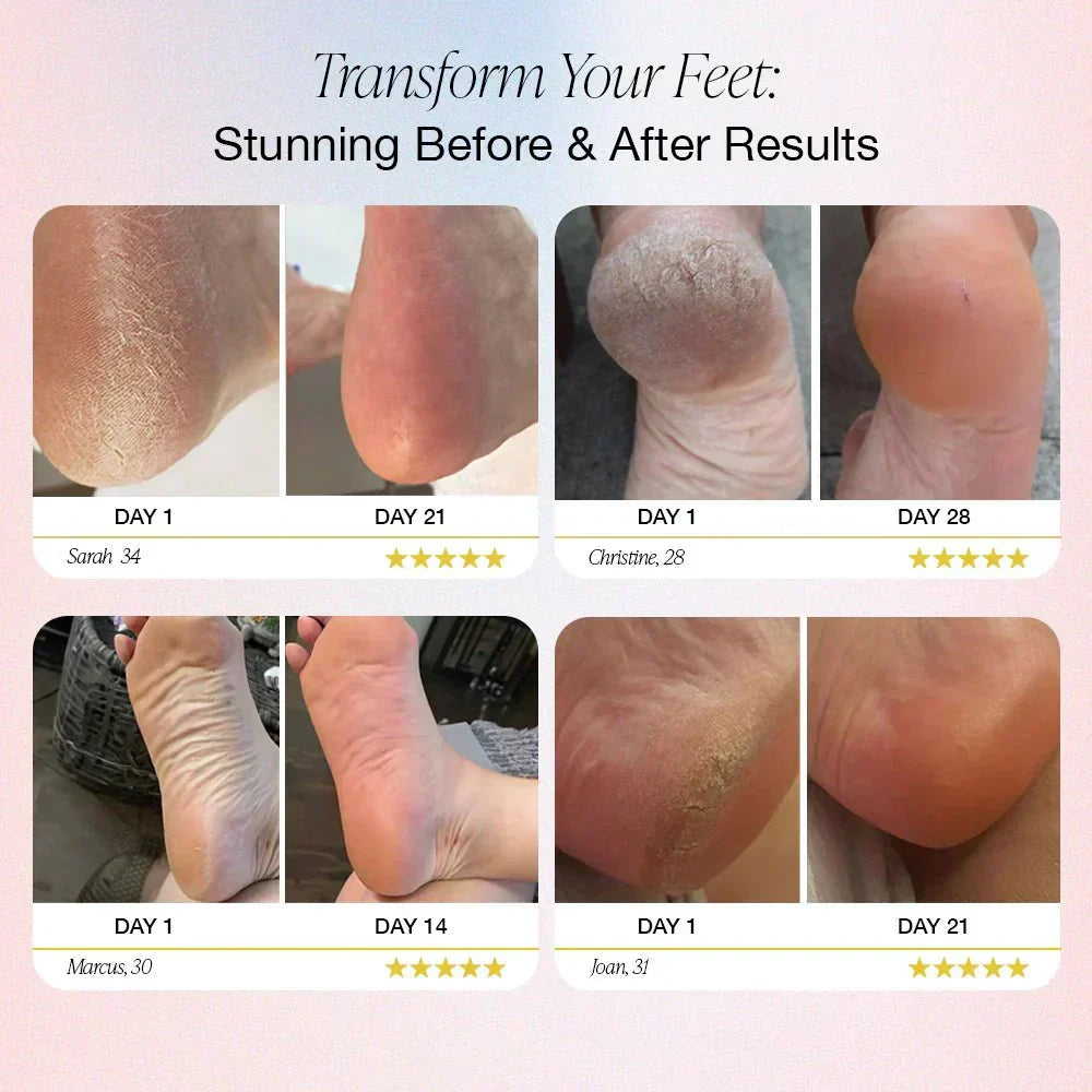 Dermave™ Electric Foot Callus Remover.